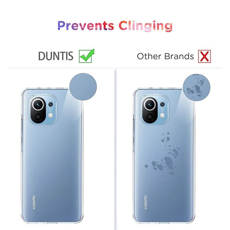 Capa Clear TPU Ultra-Thin Zelv Shield - Xiaomi